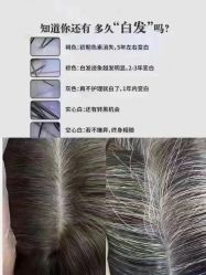 -顶尚堂白发脱发养发