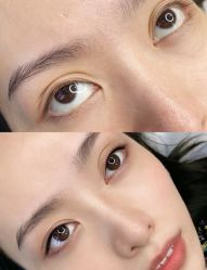 -郡艺医疗美容·微整·眼鼻吸脂
