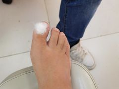 -新甲连锁灰指甲·甲沟炎·鸡眼(黑龙江路店)