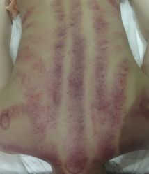 -成都伊贝丝美容美胸SPA会所