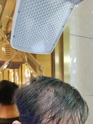 -碧莲盛·不剃发植发