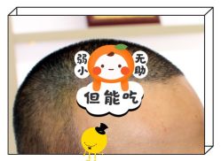 -大麦微针植发全国连锁