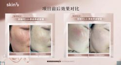 -SKIN79皮肤管理中心
