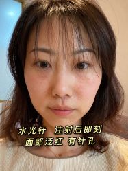 -天津时光诺颜·轻医美·轮廓抗衰中心