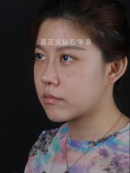 -北京米扬丽格医疗美容·联合丽格鼻整形中心