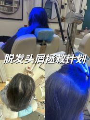 -菩叶脱发白发中心