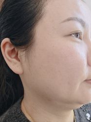 -长沙雅美医疗美容医院