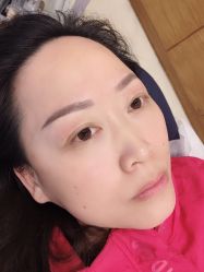 -郡艺医疗美容·微整·眼鼻吸脂