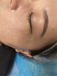 -长沙雅美医疗美容医院