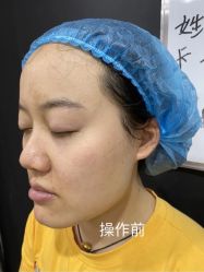 -Yestar艺星医疗美容医院
