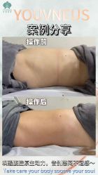 -半岛故事·法儿曼抗衰·indiba中心