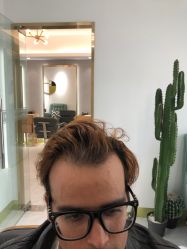 -发饰美男士增发补发假发定制店