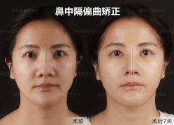 -北京米扬丽格医疗美容·联合丽格鼻整形中心