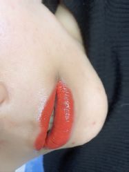 -郡艺医疗美容·微整·眼鼻吸脂