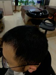 -碧莲盛·不剃发植发