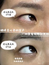 -LUNA皮相美·骨相美高级美感