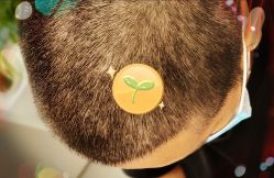 -大麦微针植发全国连锁