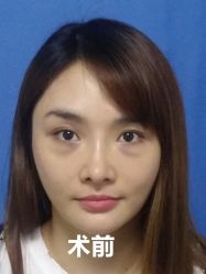 -广州健丽·去眼袋医疗美容机构