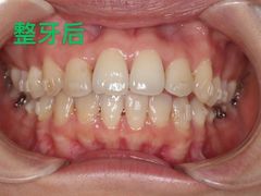-极光口腔·矫正种植修复(锦江店)