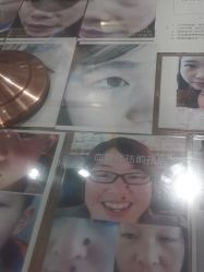 -痣斑堂·取大痣