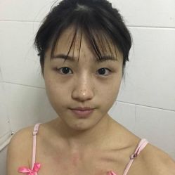 -小忠丽格医美