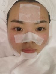 -蚌埠国色医疗美容医院•眼鼻整形
