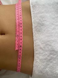 -肥三针腧穴瘦身馆