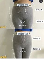 -漂亮妈妈通乳·塑形·产后恢复(奥体店)