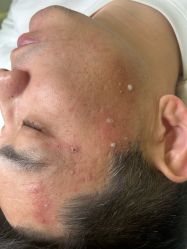 -清疣美疣·痣·斑净肤中心