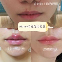 -AiCure 埃可儿·韩国医学皮肤管理