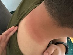 -柯尼希湖