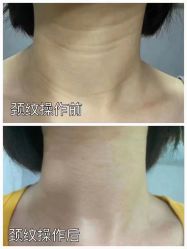 -清华大学玉泉医院-医疗美容科