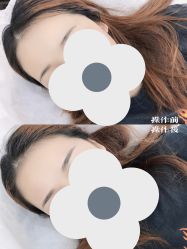 -西施无菌半永久纹绣眉眼影唇轻增发纹发际线