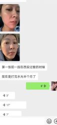 -LUNA皮相美·骨相美高级美感