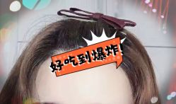 -大麦微针植发全国连锁