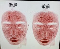 -skin79皮肤管理中心