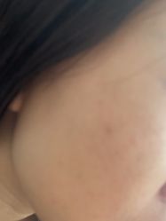 -广州美莱医疗美容医院