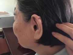 宝山斯达克助听器老人佩戴效果-宁耳听力助听器奥迪康·峰力·西门子(宝山店)
