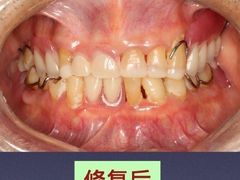 -团圆口腔·种植中心(锦江院区)