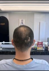 -唐风采假发补发定制