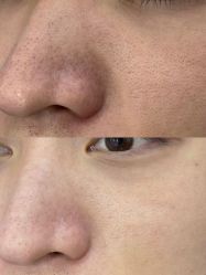 -蕾特恩专业祛痘·皮肤管理
