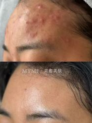 -美愈美肤MEIYU SKIN