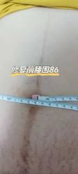 点击看大图 -贝美佳产后修复中心