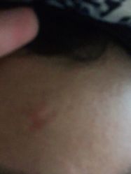 -丽美妍医疗美容·皮秒·立体分层抗衰