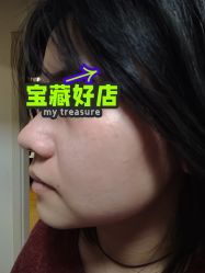 体验后-华臣医疗美容