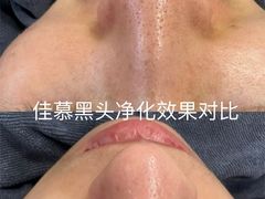 -中粮·祥云小镇