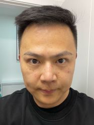 体验后-上海玫瑰医疗美容医院