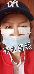 体验后-八大处整形