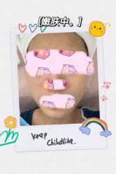 -KS科逆美肤祛痘