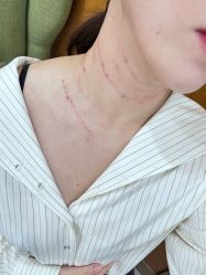 -正璞医疗美容·皮肤修复·微整注射
